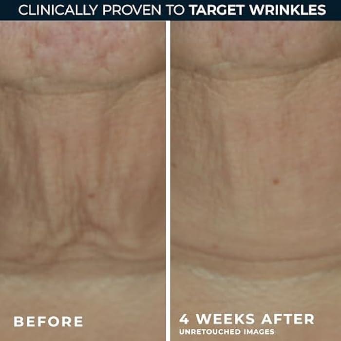 RoC Derm Correxion Retinol Firming Serum Stick with Antioxidants to Visibly Tighten and Firm Wrinkles and Laugh Lines 1.0 oz plus Retinol Eye Cream Packette - Image 4